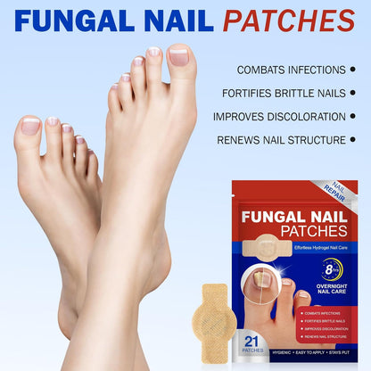 Nail Patches for Toenail Repair – 42PCS Overnight Nail Support for Damaged